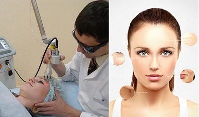 كيف يتم تجديد الجلد بالليزر